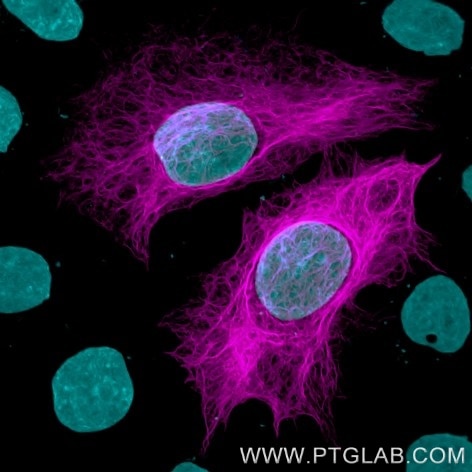 Immunofluorescence with anti-HA-Label, CoraLite ® Plus 647 (hbCL647, 1:500, magenta) visualizes HA-tagged Vimentin, transiently expressed in HeLa cells. Nuclei are stained with DAPI (cyan). Confocal images were were acquired with a 63x oil objective and post-processed.