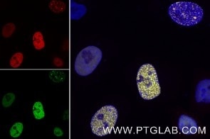 RFP-Booster Alexa Fluor® 488 (rb2AF488, 1:500, green) immunostaining of HeLa cells transiently expressing mRFP-PCNA (red). Nuclei are stained with DAPI (blue). Confocal images were post-processed.