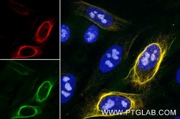 RFP-Booster Alexa Fluor® 488 (rb2AF488, 1:500, green) immunostaining of HeLa cells transiently expressing Vimentin-mCherry (red). Nucleoli are stained with anti-GNL3 (67169-1-Ig, 1:200, grey) pre-labeled with FlexAble 2.0 CoraLite® Plus 750 Antibody Labeling Kit for Mouse IgG2a (KFA544). Nuclei are stained with DAPI (blue). Confocal images were post-processed.