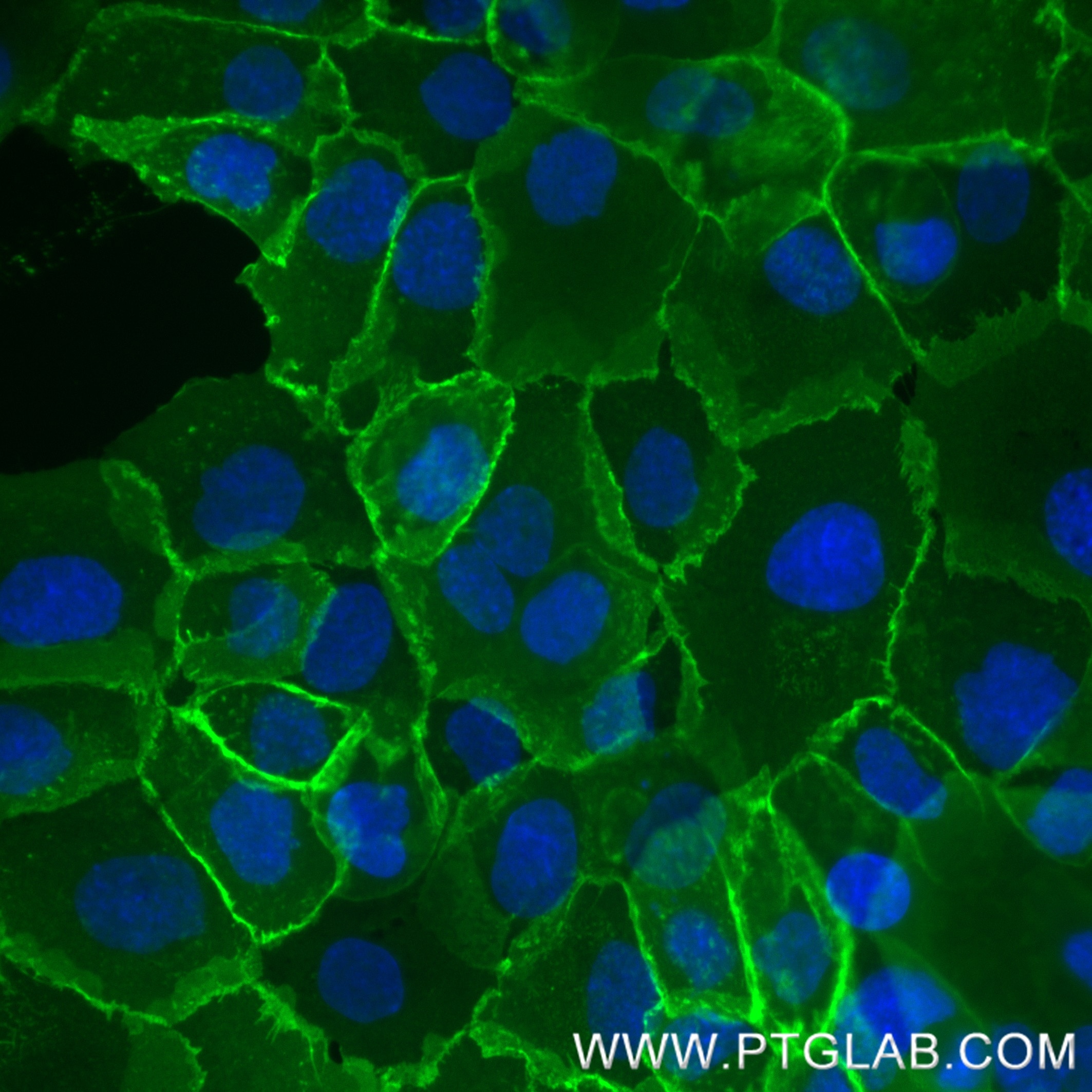 Live A431 cells were incubated with anti-human EGFR (Cetuximab biosimilar) followed by Nano-Secondary® alpaca anti-human IgG, recombinant VHH, CoraLite® Plus 488 [CTK0117] (shuGCL488-2, green). Cells were fixed and nuclei were stained with DAPI (blue). Epifluorescence images were acquired with a 40x objective and post-processed. 