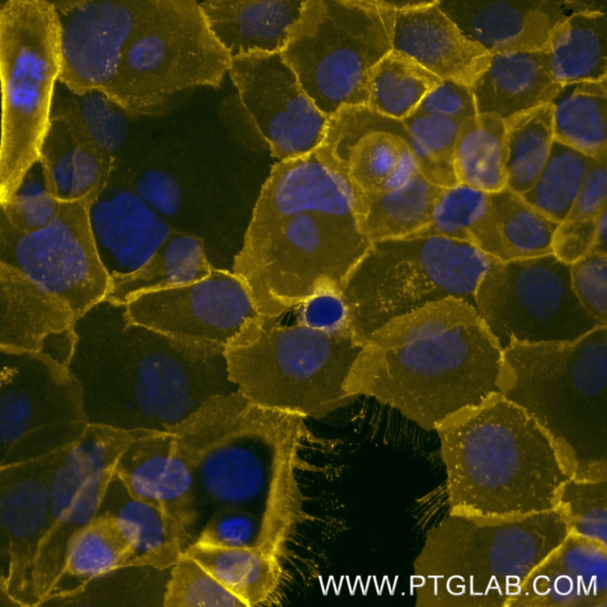 Live A431 cells were incubated with anti-human EGFR (Cetuximab biosimilar) followed by Nano-Secondary® alpaca anti-human IgG, recombinant VHH, CoraLite® Plus 555 [CTK0117] (shuGCL555-2, orange). Cells were fixed and nuclei were stained with DAPI (blue). Epifluorescence images were acquired with a 40x objective and post-processed.