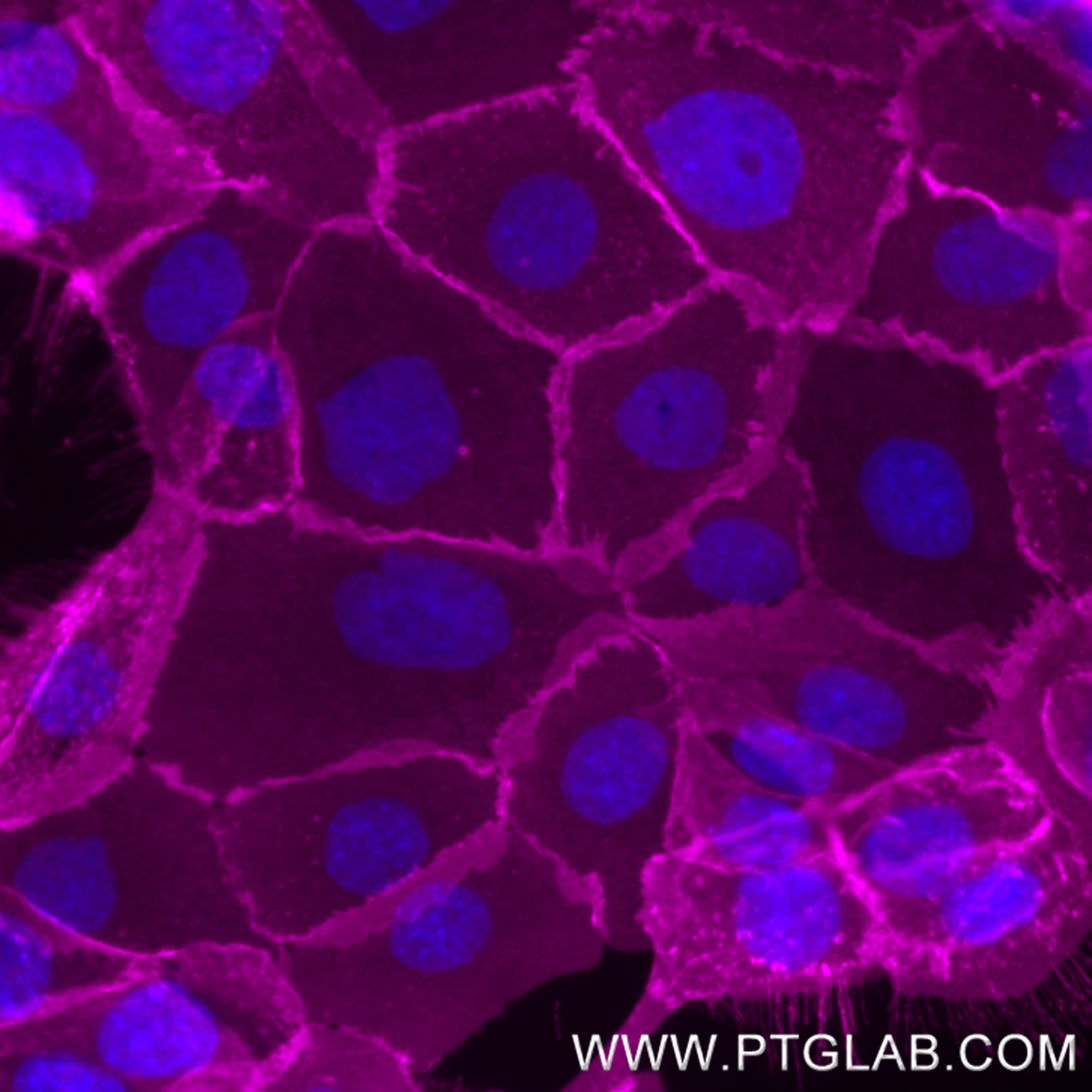 Live A431 cells were incubated with anti-human EGFR (Cetuximab biosimilar) followed by Nano-Secondary® alpaca anti-human IgG, recombinant VHH, CoraLite® Plus 647 [CTK0117] (magenta, shuGCL647-2 ). Cells were fixed and nuclei were stained with DAPI (blue). Epifluorescence images were acquired with a 40x objective and post-processed.