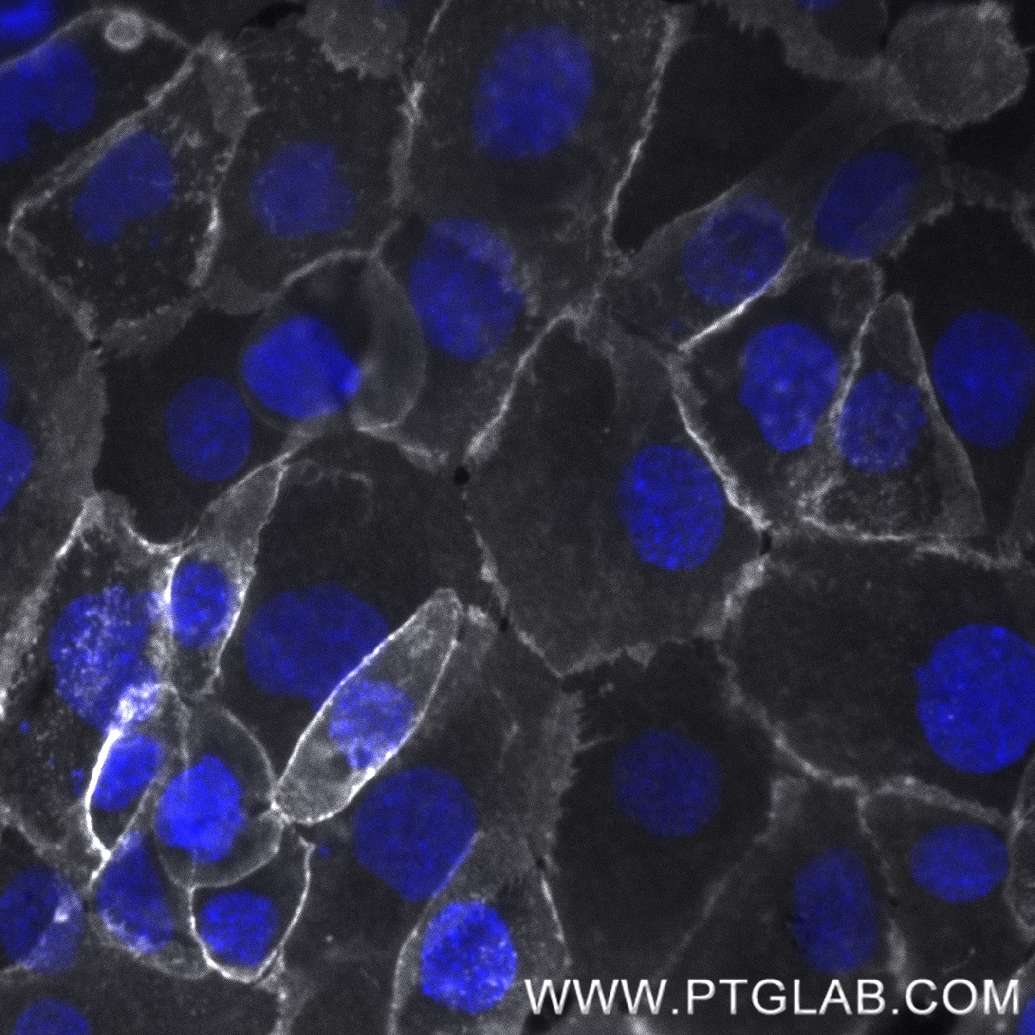 Live A431 cells were incubated with anti-human EGFR (Cetuximab biosimilar) followed by Nano-Secondary® alpaca anti-human IgG, recombinant VHH, CoraLite® Plus 750 [CTK0117] (shuGCL750-2, gray). Cells were fixed and nuclei were stained with DAPI (blue). Epifluorescence images were acquired with a 40x objective and post-processed.