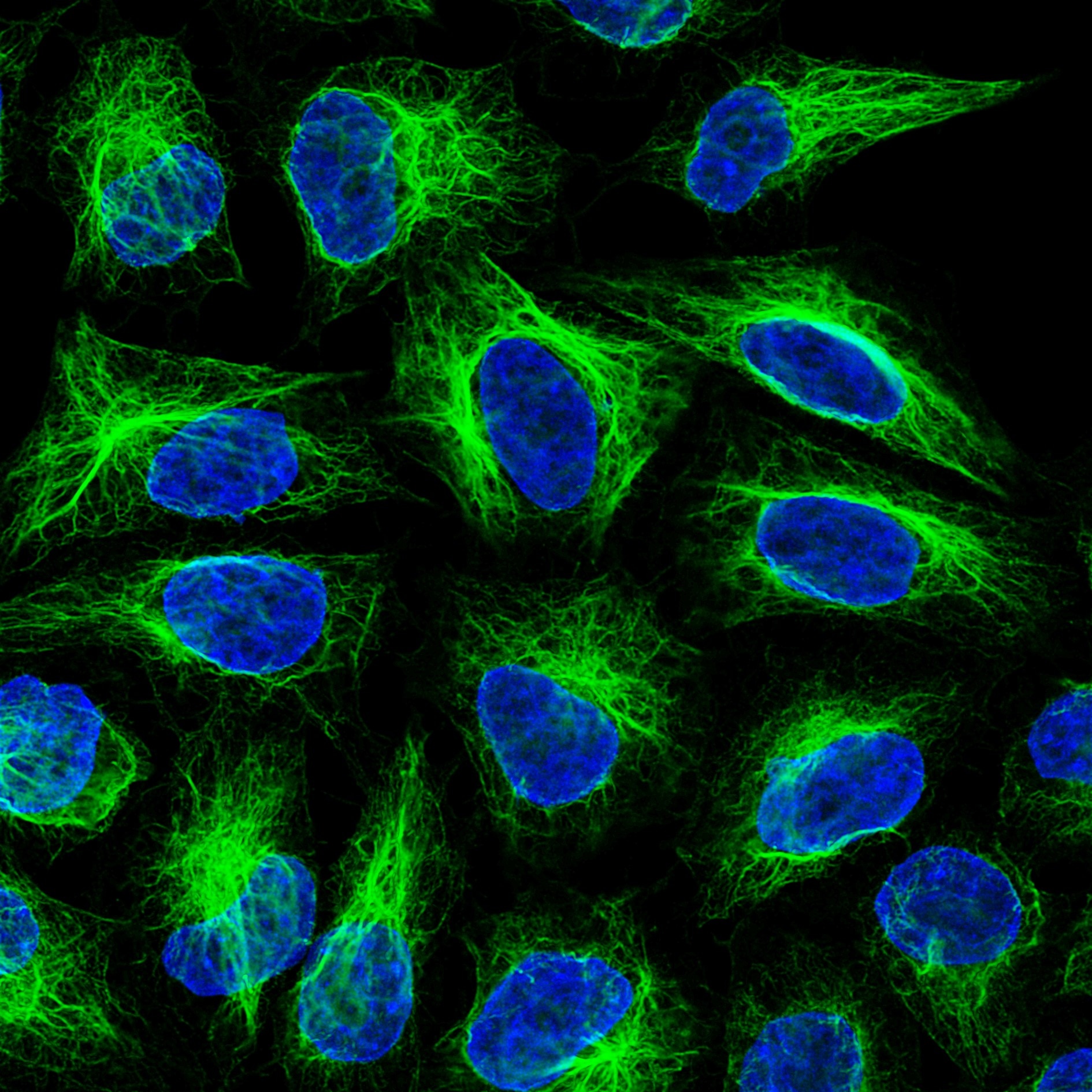 Immunofluorescence analysis of HeLa cells stained with mouse IgG1 anti-vimentin antibody and Nano-Secondary® alpaca anti-mouse IgG1, recombinant VHH, CoraLite® Plus 488 (smsG1CL488-1, green). Nuclei were stained with DAPI (blue).