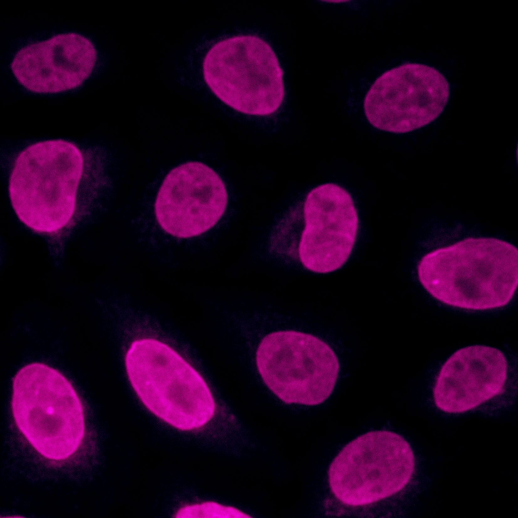 Immunofluorescence analysis of Hela cells stained with mouse IgG2a anti-Lamin B2 antibody (66240-1-Ig) and Nano-Secondary® alpaca anti-mouse IgG2a, recombinant VHH, CoraLite® Plus 750 (magenta). Nuclei were stained with DAPI (blue). Images were recorded at the Core Facility Bioimaging at the Biomedical Center, LMU Munich.