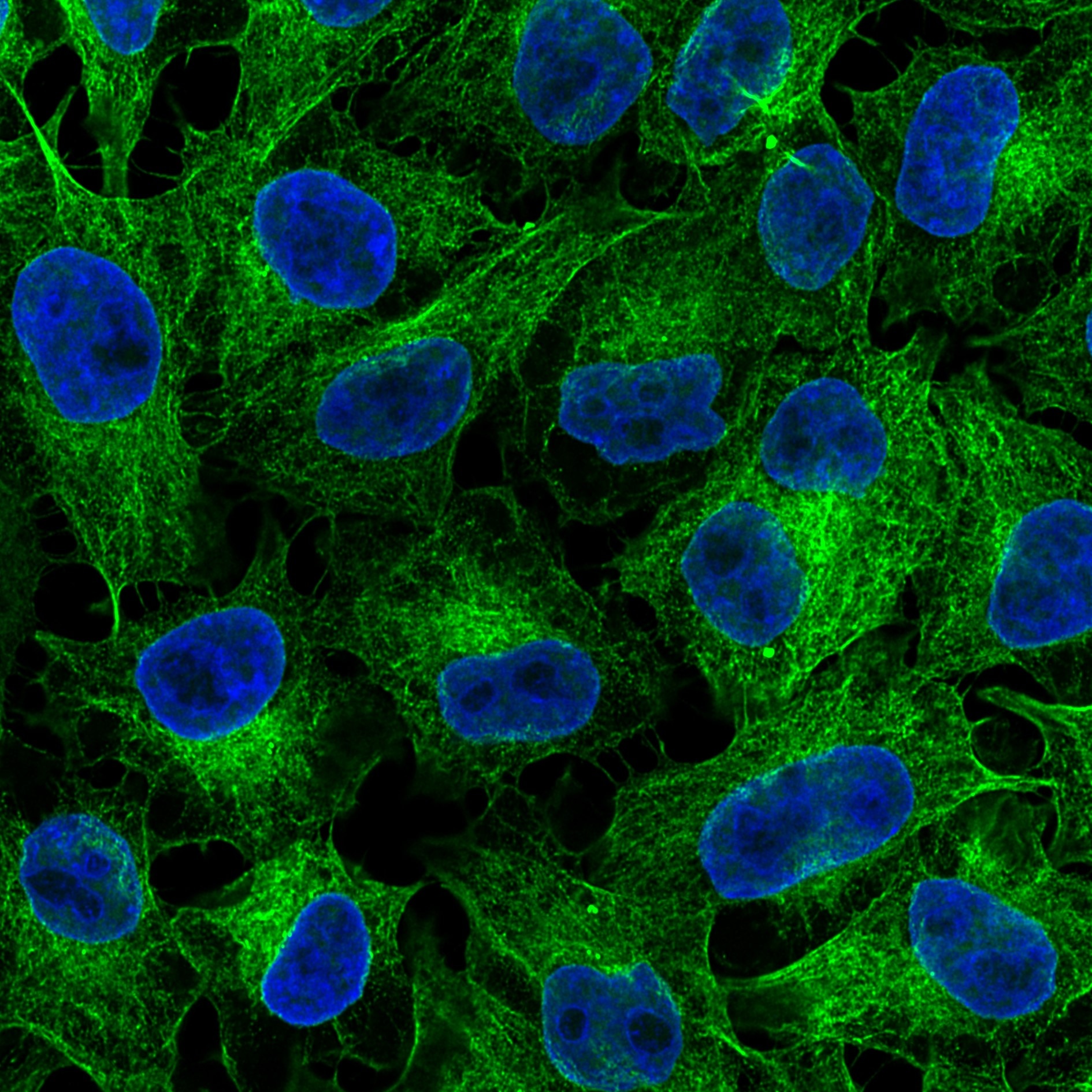 Immunofluorescence analysis of HeLa cells stained with mouse IgG2b anti-tubulin beta antibody and Nano-Secondary® alpaca anti-mouse IgG2b, recombinant VHH, CoraLite® Plus 488 (smsG2bCL488-1, green). Nuclei were stained with DAPI (blue). Images were recorded at the Core Facility Bioimaging at the Biomedical Center, LMU Munich.