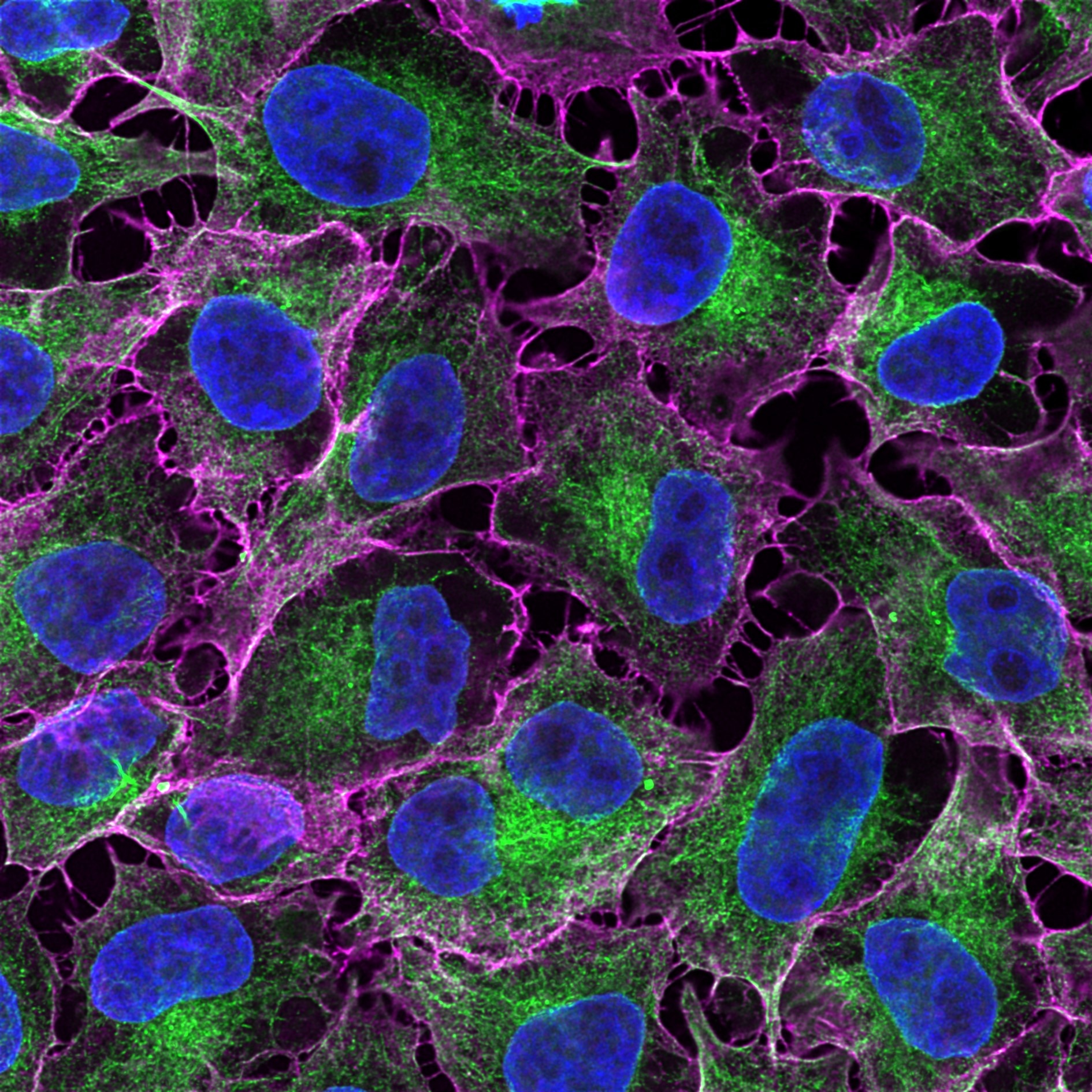 IF analysis of HeLa cells co-stained with mouse IgG2b anti-tubulin beta antibody and mouse IgG1 CD147 antibody followed by Nano-Secondary® alpaca anti-mouse IgG2b, recombinant VHH, CoraLite® Plus 488 (smsG2bCL488-1, green) and Nano-Secondary® alpaca anti-mouse IgG1, recombinant VHH, CoraLite® Plus 647 (smsG1CL647-1, magenta). Nuclei were stained with DAPI (blue).