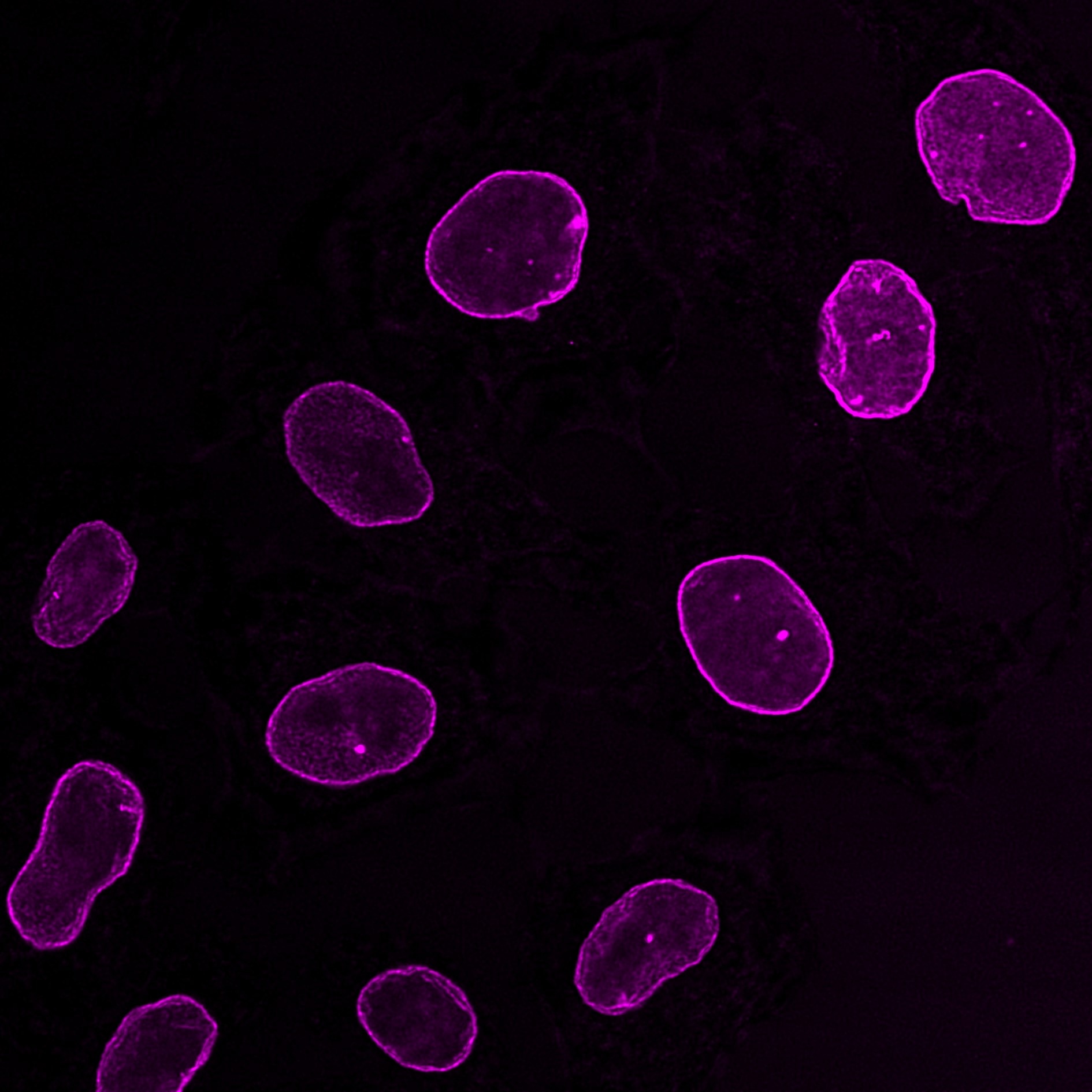 Immunofluorescence analysis of HeLa cells stained with mouse IgG2b anti-Lamin A/C antibody and Nano-Secondary® alpaca anti-mouse IgG2b, recombinant VHH, CoraLite® Plus 647 (smsG2bCL647-1, magenta). Images were recorded at the Core Facility Bioimaging at the Biomedical Center, LMU Munich.