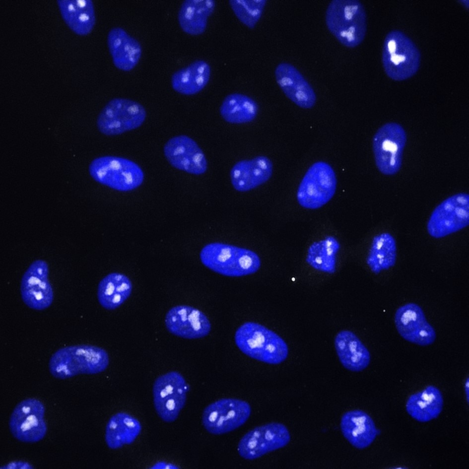 Immunofluorescence analysis of HeLa cells stained with mouse IgG2b anti-IMP3 antibody (66247-1-Ig) and Nano-Secondary® alpaca anti-mouse IgG2b, recombinant VHH, CoraLite® Plus 750 (smsG1CL750-1, gray). Nuclei were stained with DAPI (blue). 