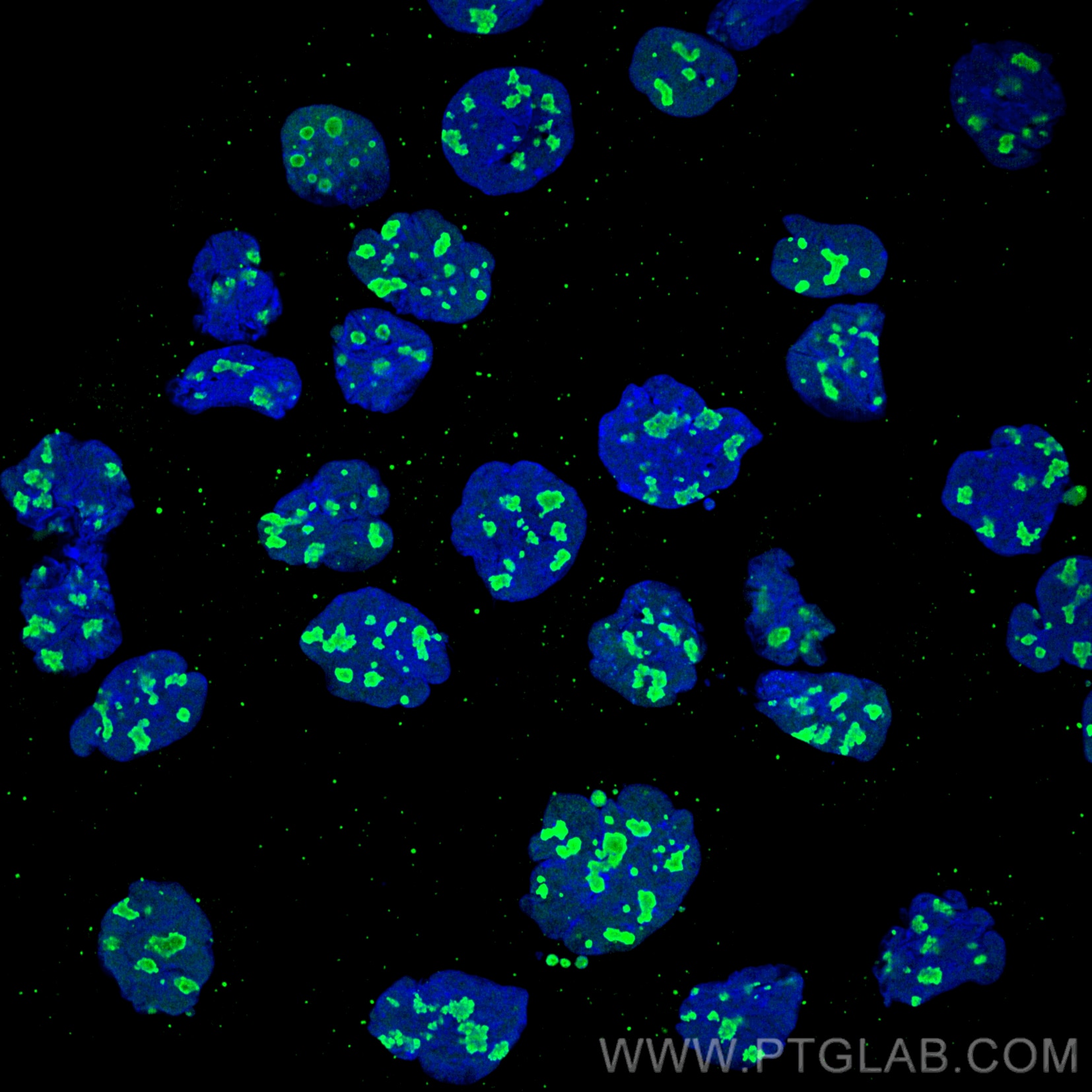 Immunofluorescence analysis of A431 cells stained with rabbit anti-NCL antibody (10556-1-AP, green) and Nano-Secondary® alpaca anti-rabbit IgG, recombinant VHH, CoraLite® Plus 488 (srb2GCL488-1), 1:500. Nuclei were stained with DAPI (blue). Images were recorded at the Core Facility Bioimaging at the Biomedical Center, LMU Munich.