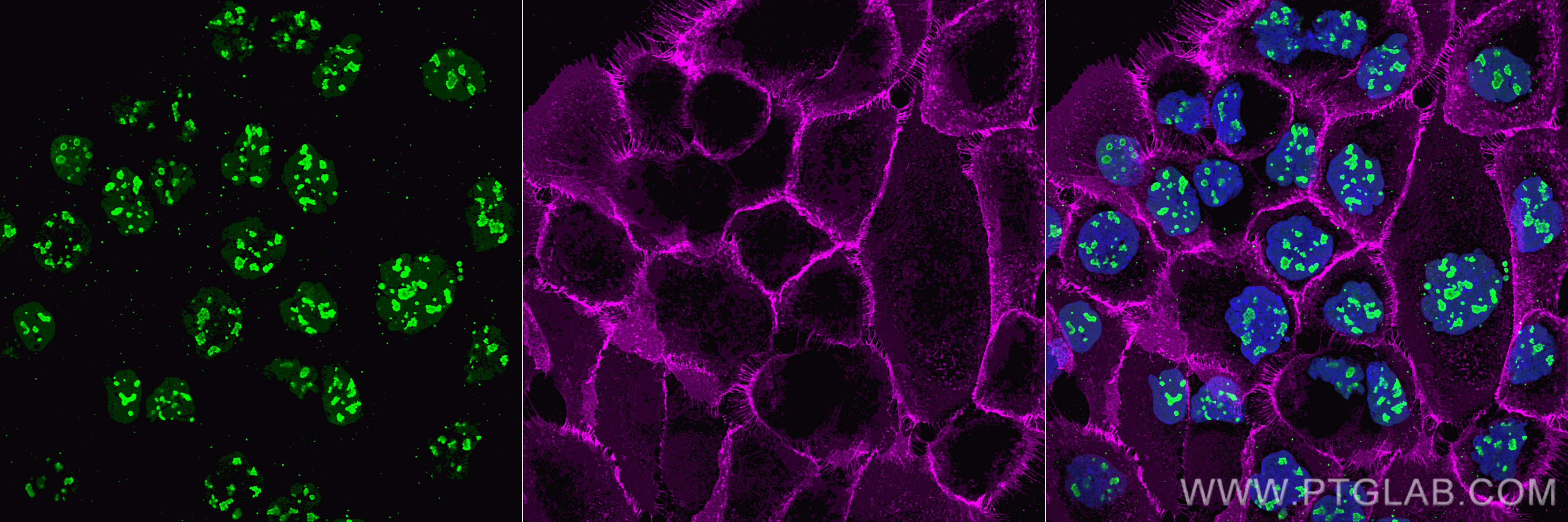 Immunofluorescence analysis of A431 cells co-stained with anti-EGFR antibody (cetuximab biosimilar, huIgG1, magenta) and anti-NCL antibody (10556-1-AP, green). Nano-Secondary® alpaca anti-human IgG, recombinant VHH, CoraLite® Plus 647 (shuGCL647-2), 1:500 and Nano-Secondary® alpaca anti-rabbit IgG, recombinant VHH, CoraLite® Plus 488 (srb2GCL488-1), 1:500 were used for detection. Nuclei were stained with DAPI. Merged image on the right shows an overlay of both channels and DAPI (blue). ​Images were recorded at the Core Facility Bioimaging at the Biomedical Center, LMU Munich.