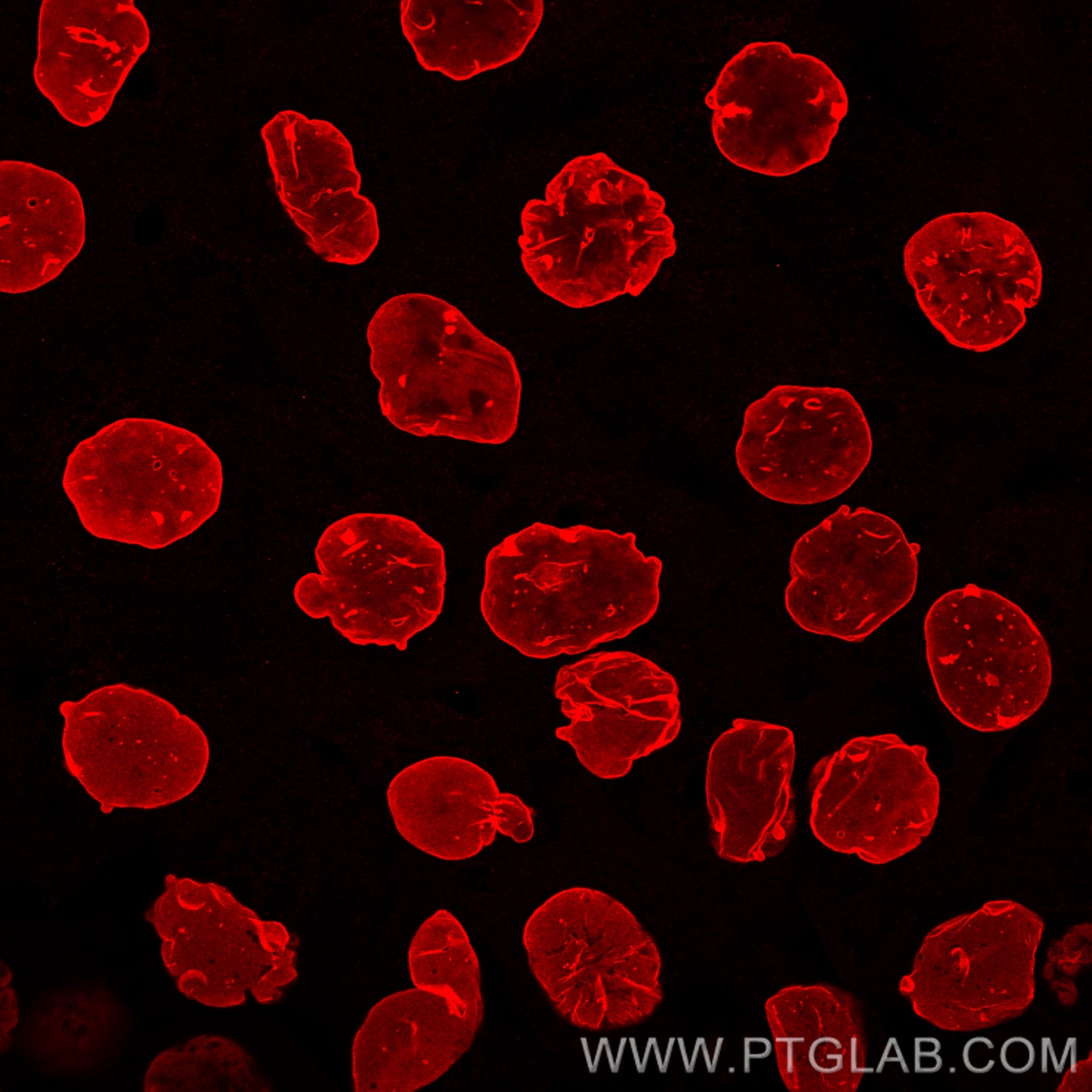 Immunofluorescence analysis of A431 cells stained with rabbit anti-Lamin B1 antibody (12987-1-AP, red) and Nano-Secondary® alpaca anti-rabbit IgG, recombinant VHH, CoraLite® Plus 555 (srb2GCL555-1), 1:500. Nuclei were stained with DAPI. Images were recorded at the Core Facility Bioimaging at the Biomedical Center, LMU Munich.