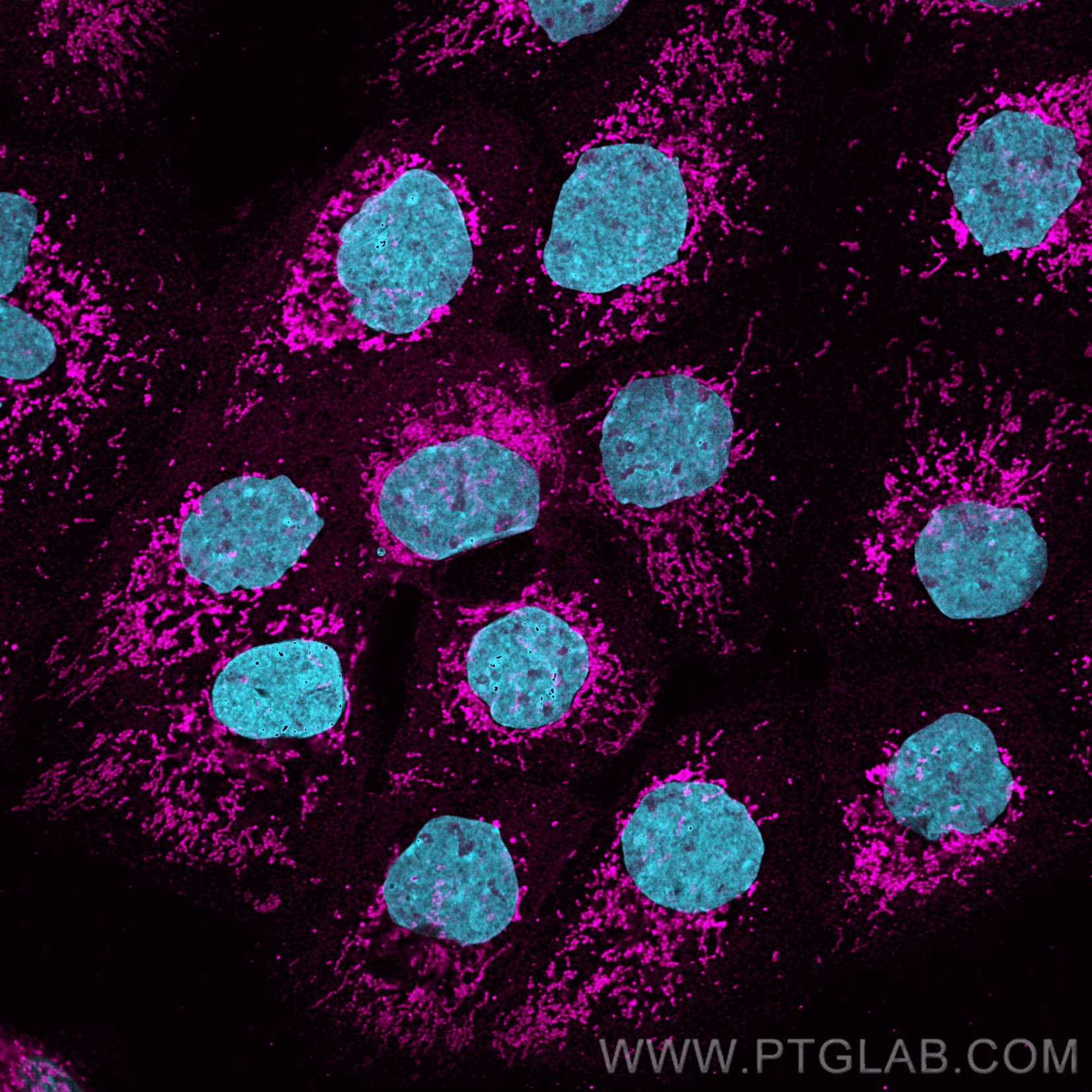 Immunofluorescence analysis of A431 cells stained with rabbit anti-COXIV antibody (11242-1-AP, magenta) and Nano-Secondary® alpaca anti-rabbit IgG, recombinant VHH, CoraLite® Plus 647 (srb2GCL647-1), 1:500. Nuclei were stained with DAPI (blue).