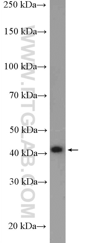 Western Blot (WB) analysis of HeLa cells using Reticulocalbin 3 Polyclonal antibody (27497-1-AP)