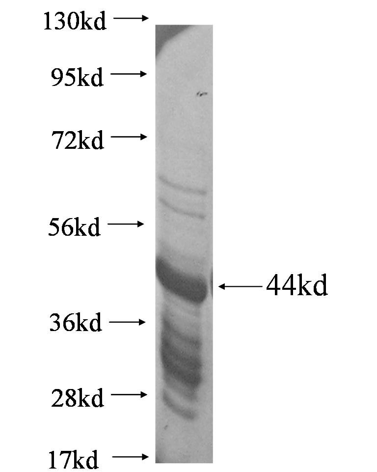 Rex2 fusion protein Ag0471 SDS-PAGE