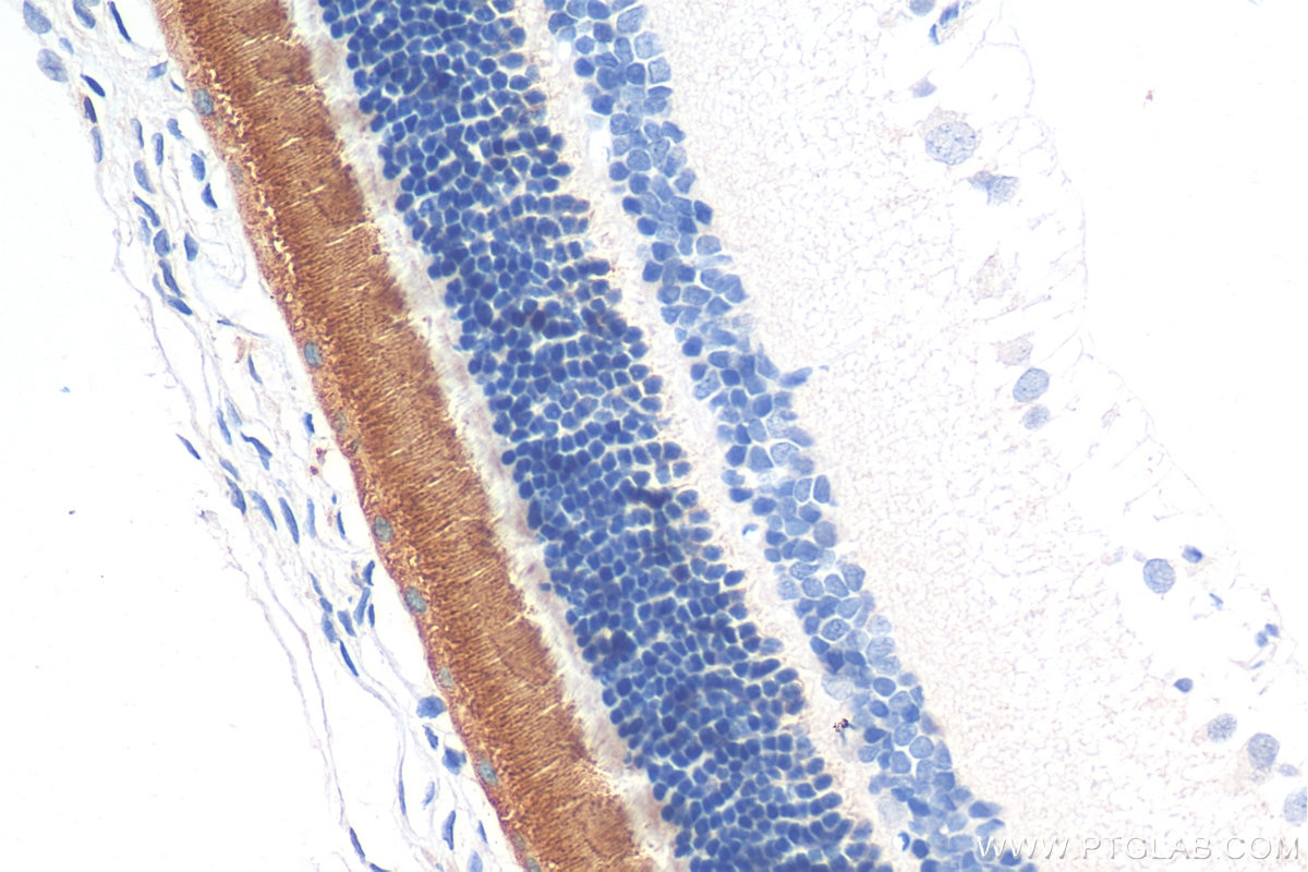 IHC staining of rat eye using 30438-1-AP