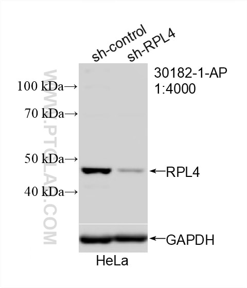 Ribosomal protein L4