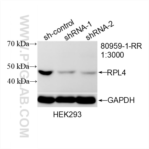 Western Blot (WB) analysis of HEK-293 cells using Ribosomal protein L4 Recombinant antibody (80959-1-RR)