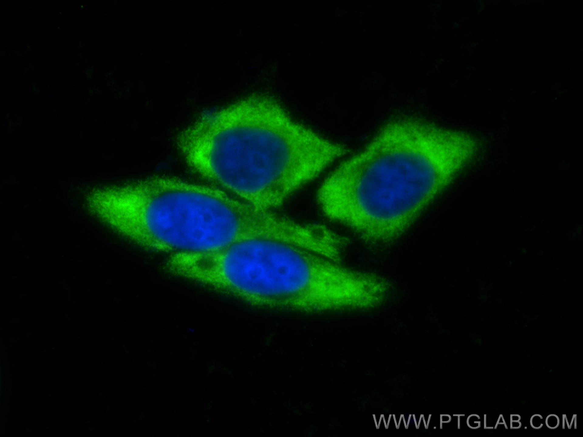 Immunofluorescence (IF) / fluorescent staining of HepG2 cells using CoraLite® Plus 488-conjugated Ribosomal protein L4 (CL488-11302)