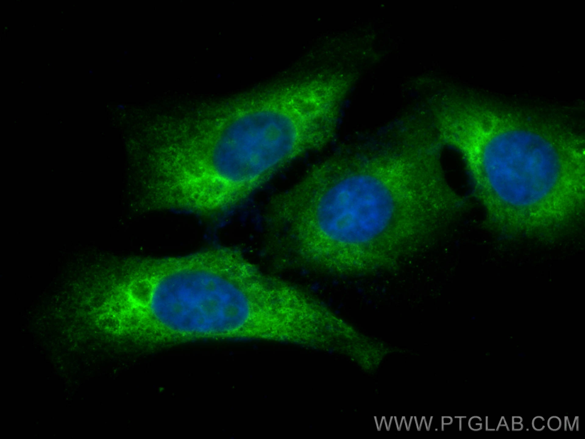 Ribosomal protein L4