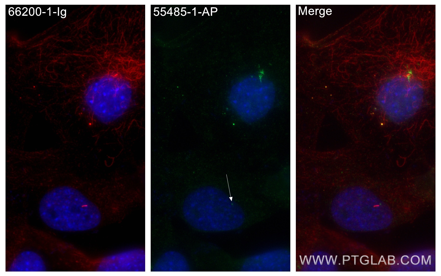 Immunofluorescence (IF) / fluorescent staining of C2C12 cells using Rootletin Polyclonal antibody (55485-1-AP)