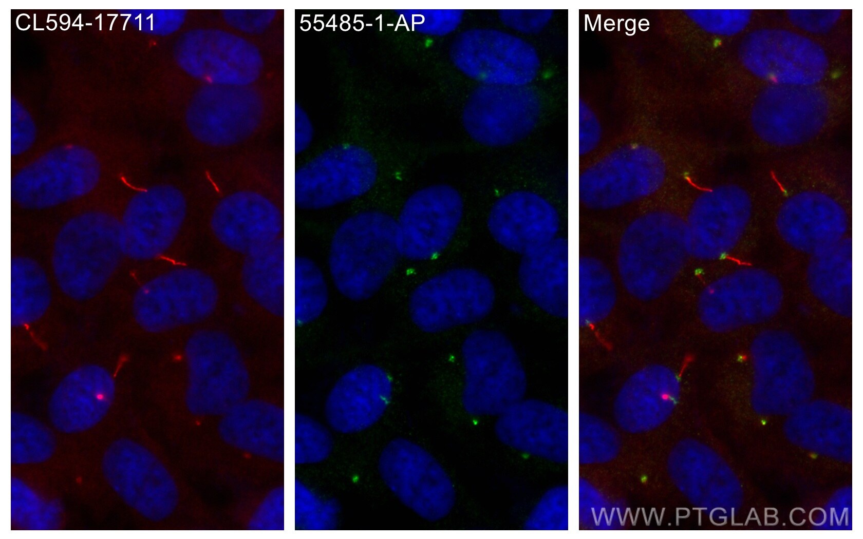 Immunofluorescence (IF) / fluorescent staining of hTERT-RPE1 cells using Rootletin Polyclonal antibody (55485-1-AP)