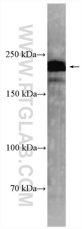 Western Blot (WB) analysis of mouse brain tissue using Rootletin Polyclonal antibody (55485-1-AP)