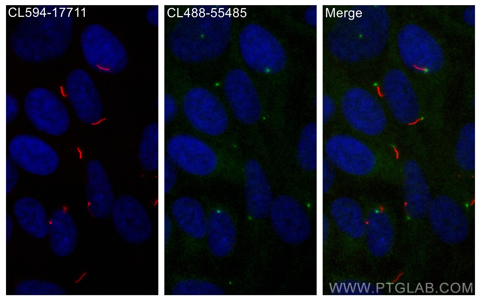 Immunofluorescence (IF) / fluorescent staining of hTERT-RPE1 cells using CoraLite® Plus 488-conjugated Rootletin Polyclonal (CL488-55485)