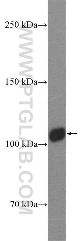 Western Blot (WB) analysis of HeLa cells using Rubicon Polyclonal antibody (55157-1-AP)