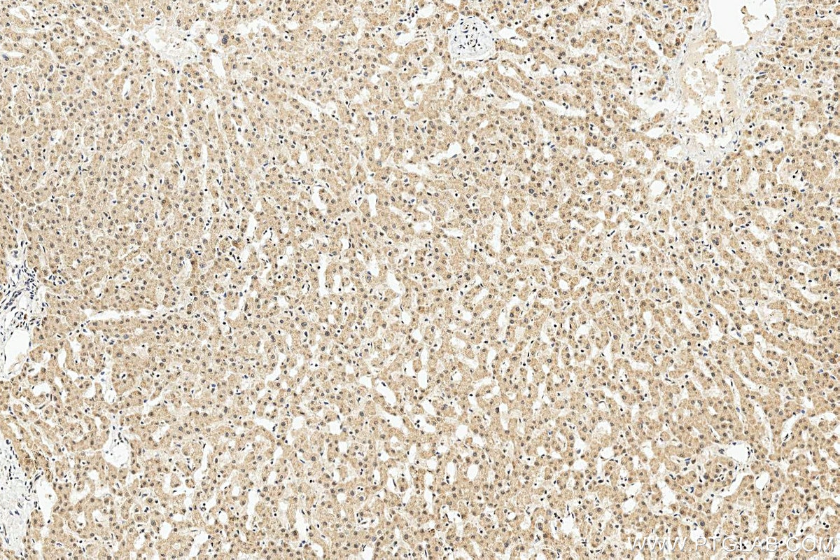 IHC staining of human liver using 27865-1-AP Immunohistochemistry (IHC) staining of human liver tissue using RyDEN Polyclonal antibody (27865-1-AP)