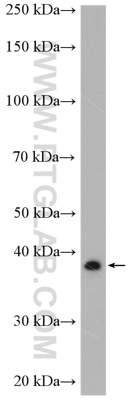 Western Blot (WB) analysis of THP-1 cells using RyDEN Polyclonal antibody (27865-1-AP)
