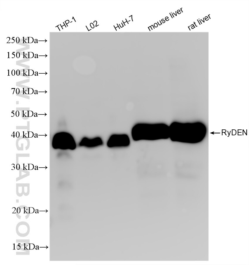 WB analysis using 88428-1-RR Western Blot (WB) analysis of various lysates using RyDEN Recombinant monoclonal antibody (88428-1-RR)