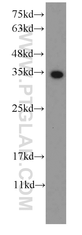 Western Blot (WB) analysis of Recombinant protein using S1 tag Monoclonal antibody (66165-1-Ig)