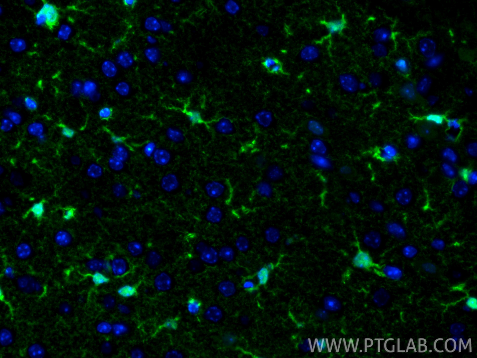 Immunofluorescence (IF) / fluorescent staining of mouse brain tissue using S100B Recombinant antibody (82271-8-RR)