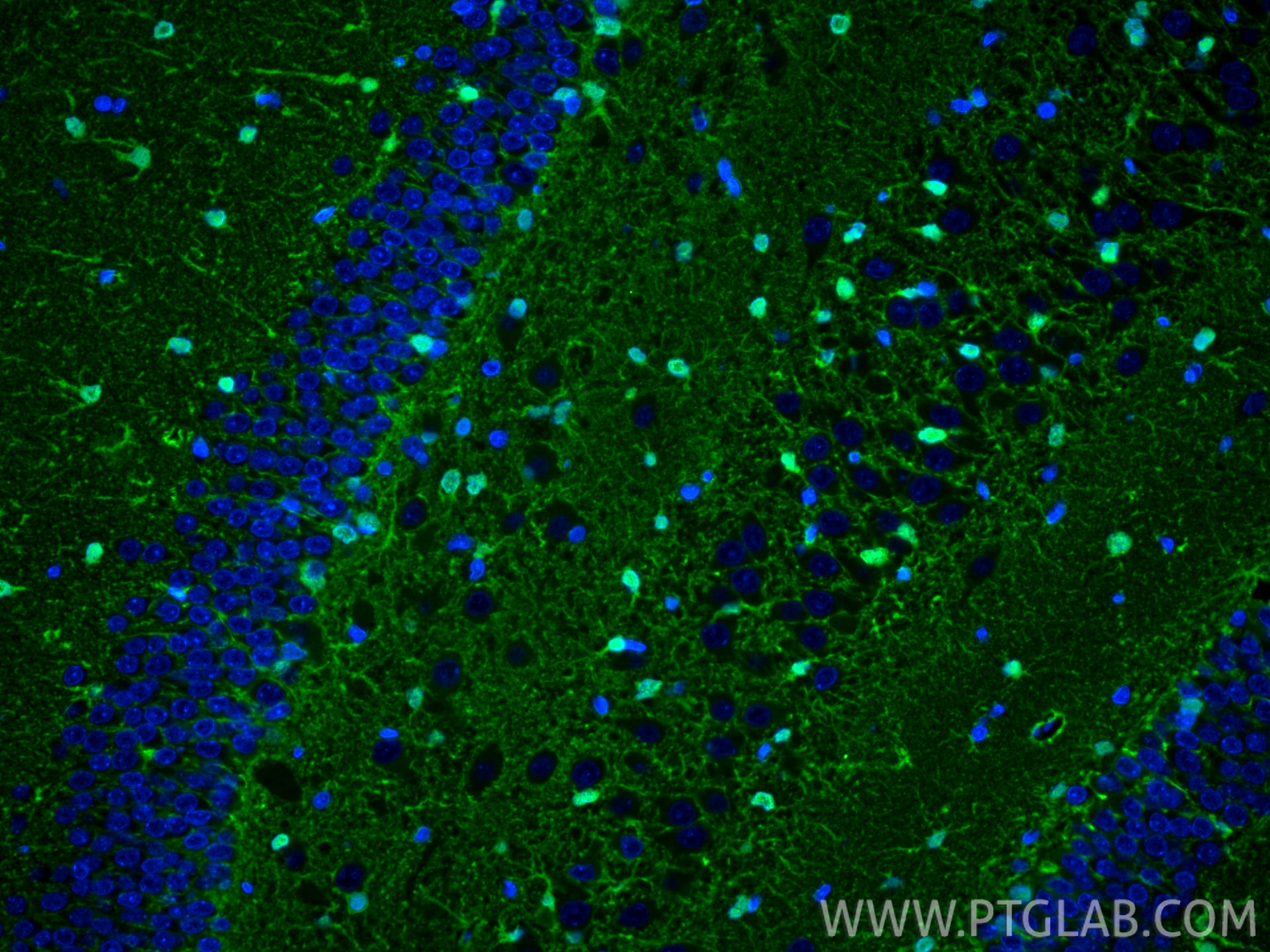 Immunofluorescence (IF) / fluorescent staining of rat brain tissue using S100B Recombinant antibody (82271-8-RR)
