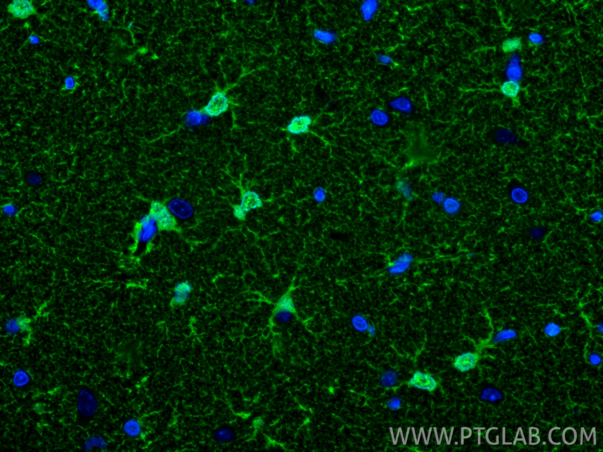 Immunofluorescence (IF) / fluorescent staining of rat brain tissue using S100B Recombinant antibody (82271-8-RR)