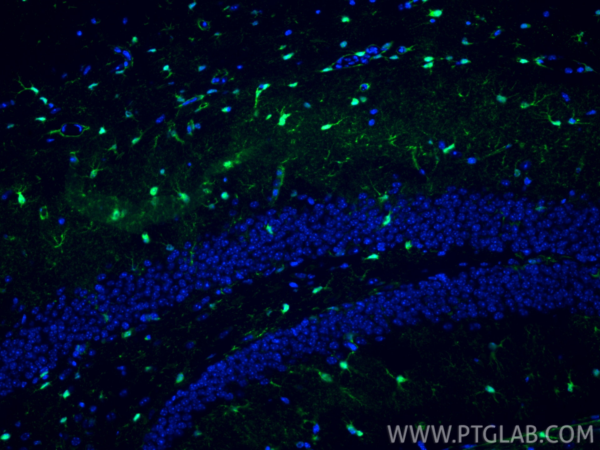 Immunofluorescence (IF) / fluorescent staining of mouse brain tissue using S100B Recombinant monoclonal antibody (82271-8-RR)