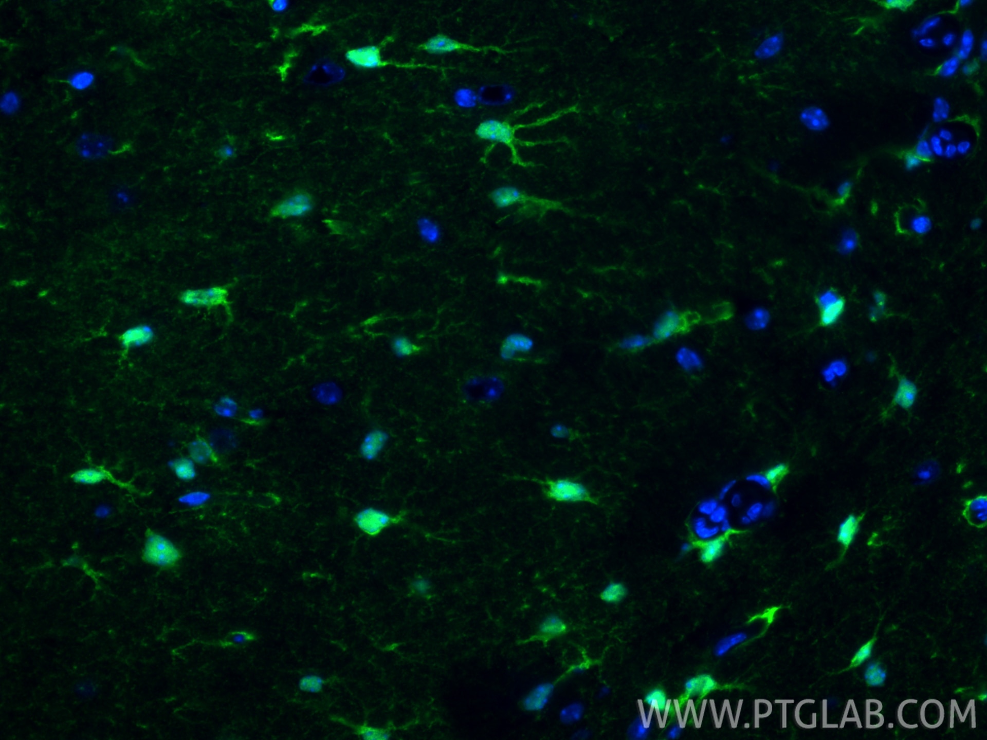 Immunofluorescence (IF) / fluorescent staining of mouse brain tissue using S100B Recombinant monoclonal antibody (82271-8-RR)