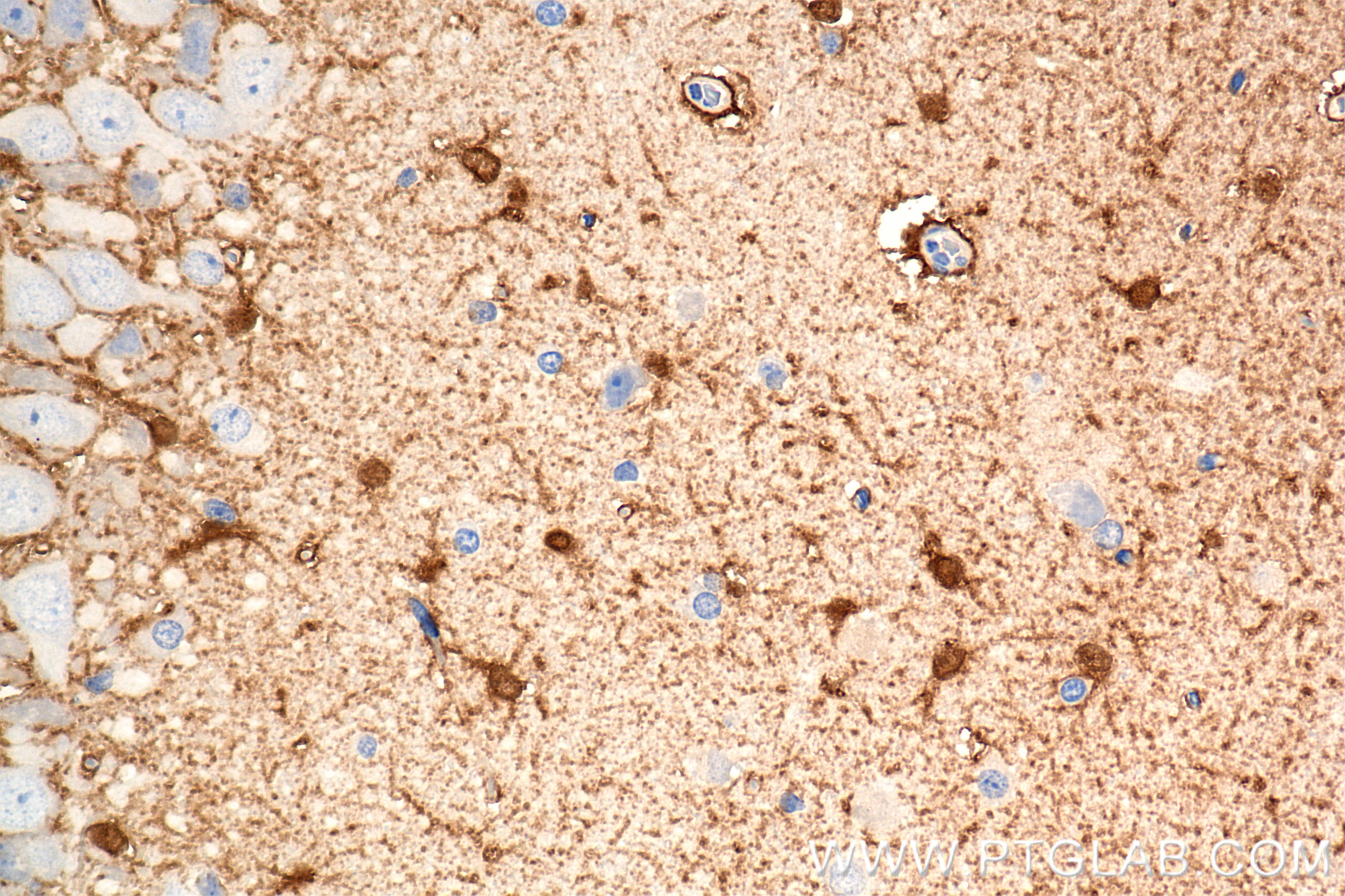 Immunohistochemistry (IHC) staining of rat brain tissue using S100B Recombinant antibody (82271-8-RR)