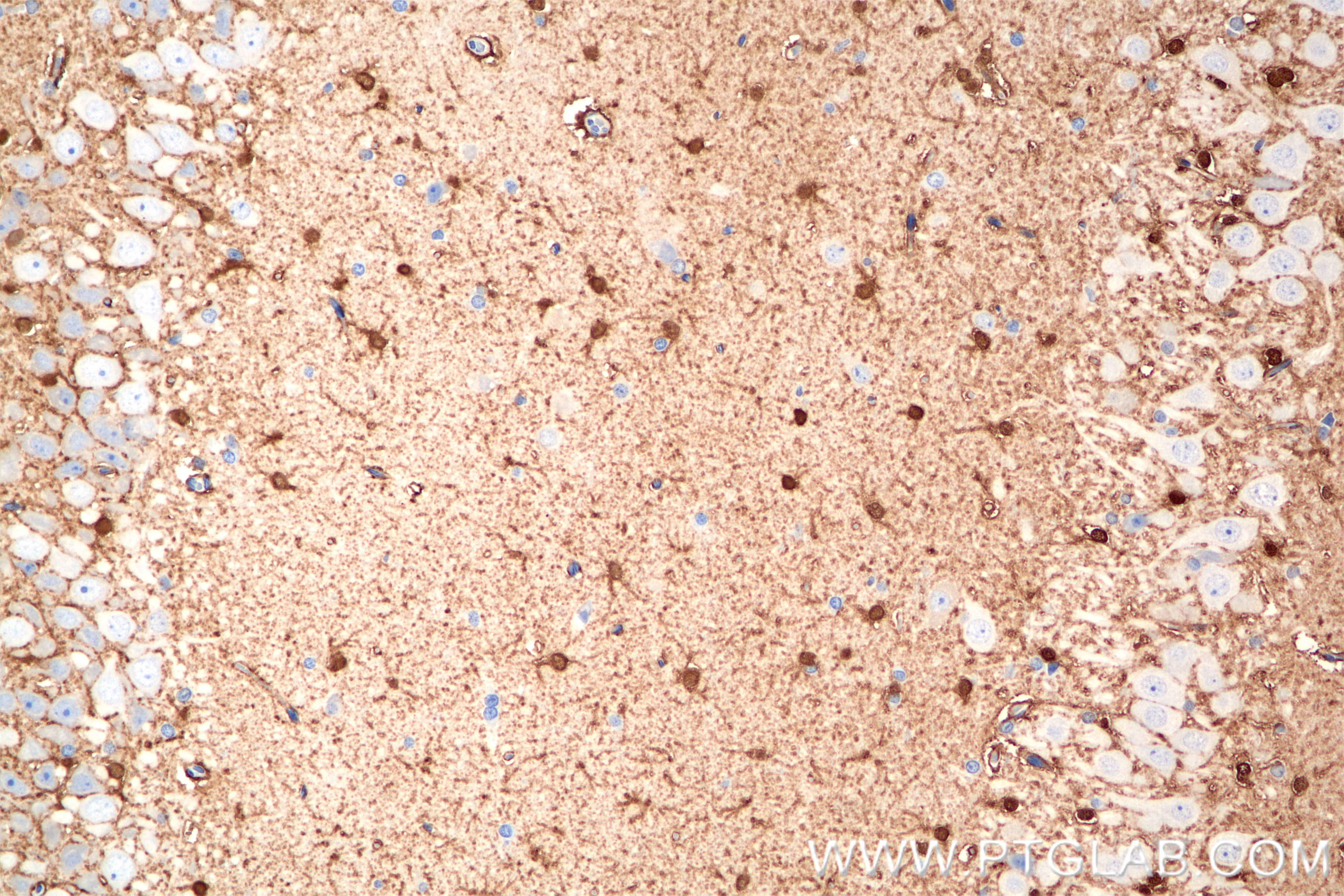 Immunohistochemistry (IHC) staining of rat brain tissue using S100B Recombinant antibody (82271-8-RR)