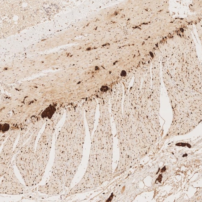 IHC staining of human small intestine using 82271-8-RR Immunohistochemistry (IHC) staining of human small intestine tissue using S100B Recombinant monoclonal antibody (82271-8-RR)