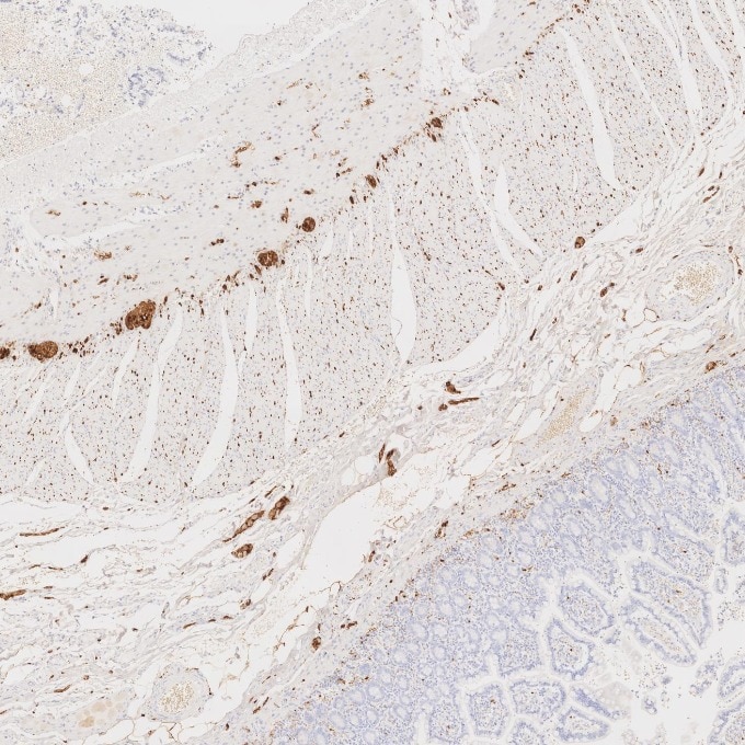 IHC staining of human small intestine using 82271-8-RR Immunohistochemistry (IHC) staining of human small intestine tissue using S100B Recombinant monoclonal antibody (82271-8-RR)