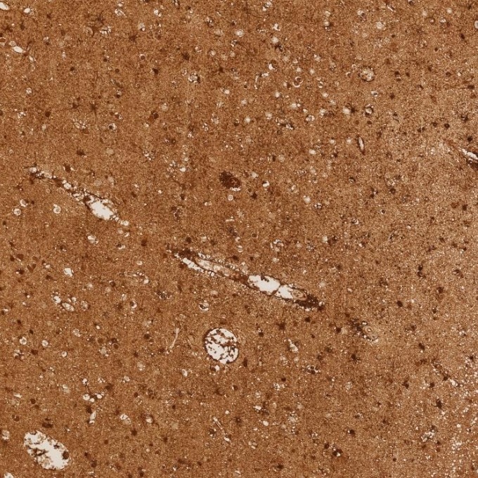 IHC staining of human brain using 82271-8-RR Immunohistochemistry (IHC) staining of human brain tissue using S100B Recombinant monoclonal antibody (82271-8-RR)