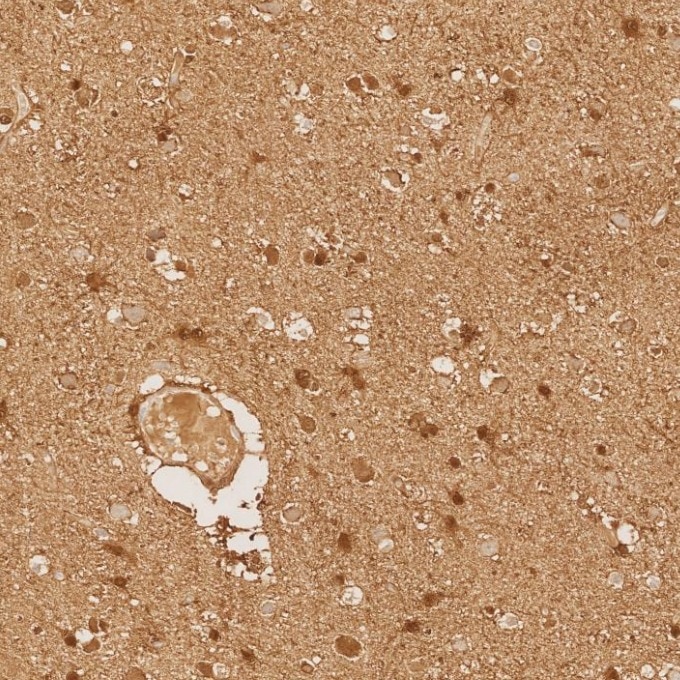 IHC staining of human brain using 82271-8-RR Immunohistochemistry (IHC) staining of human brain tissue using S100B Recombinant monoclonal antibody (82271-8-RR)