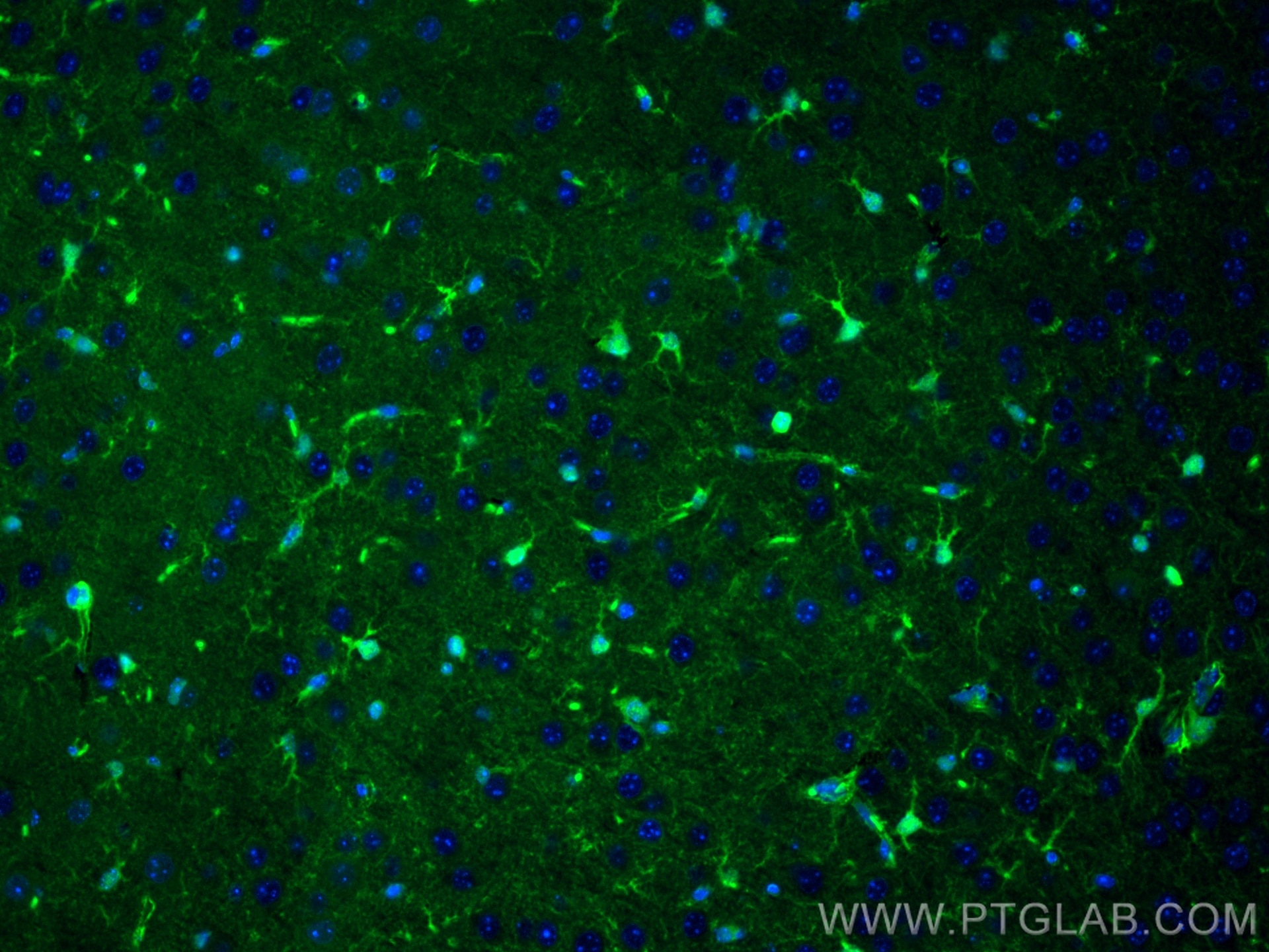 Immunofluorescence (IF) / fluorescent staining of mouse brain tissue using CoraLite® Plus 488-conjugated S100 Beta Polyclonal (CL488-15146)