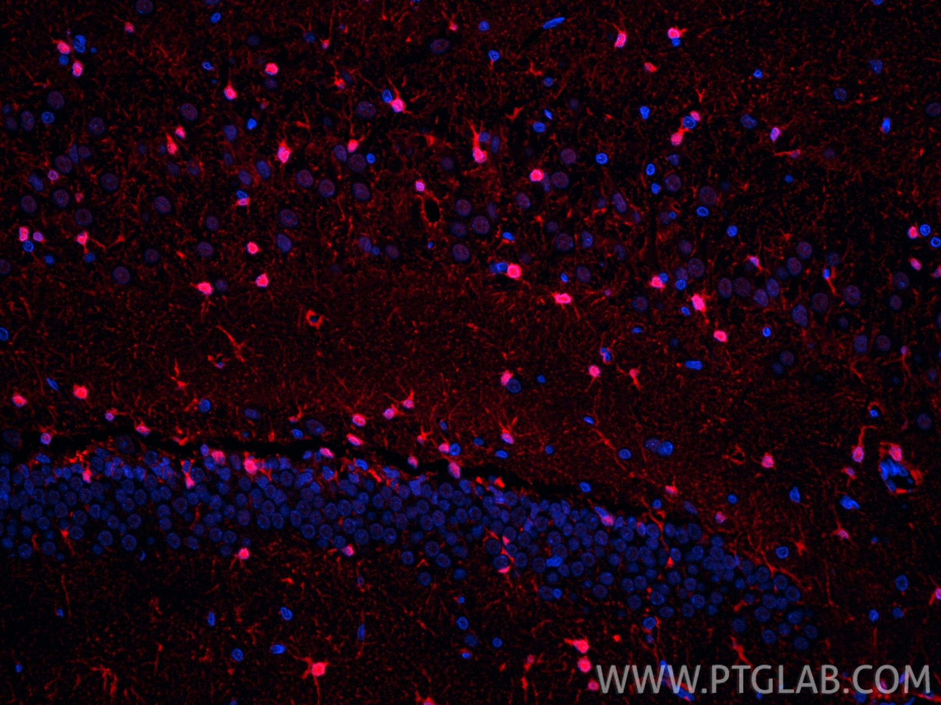IF Staining of rat brain using CL594-15146 Immunofluorescence (IF) / fluorescent staining of rat brain tissue using CoraLite®594-conjugated S100B Polyclonal antibody (CL594-15146)
