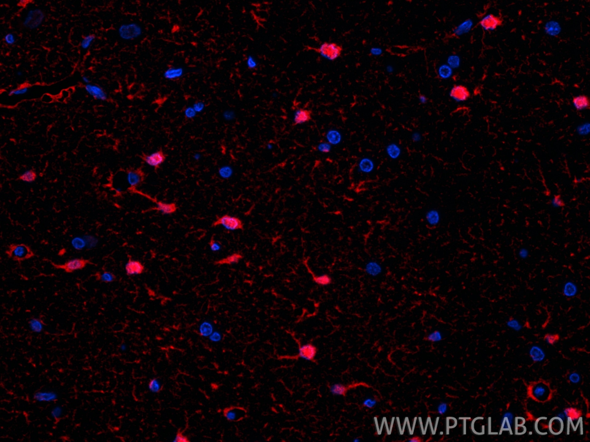 IF Staining of rat brain using CL594-15146 Immunofluorescence (IF) / fluorescent staining of rat brain tissue using CoraLite®594-conjugated S100B Polyclonal antibody (CL594-15146)