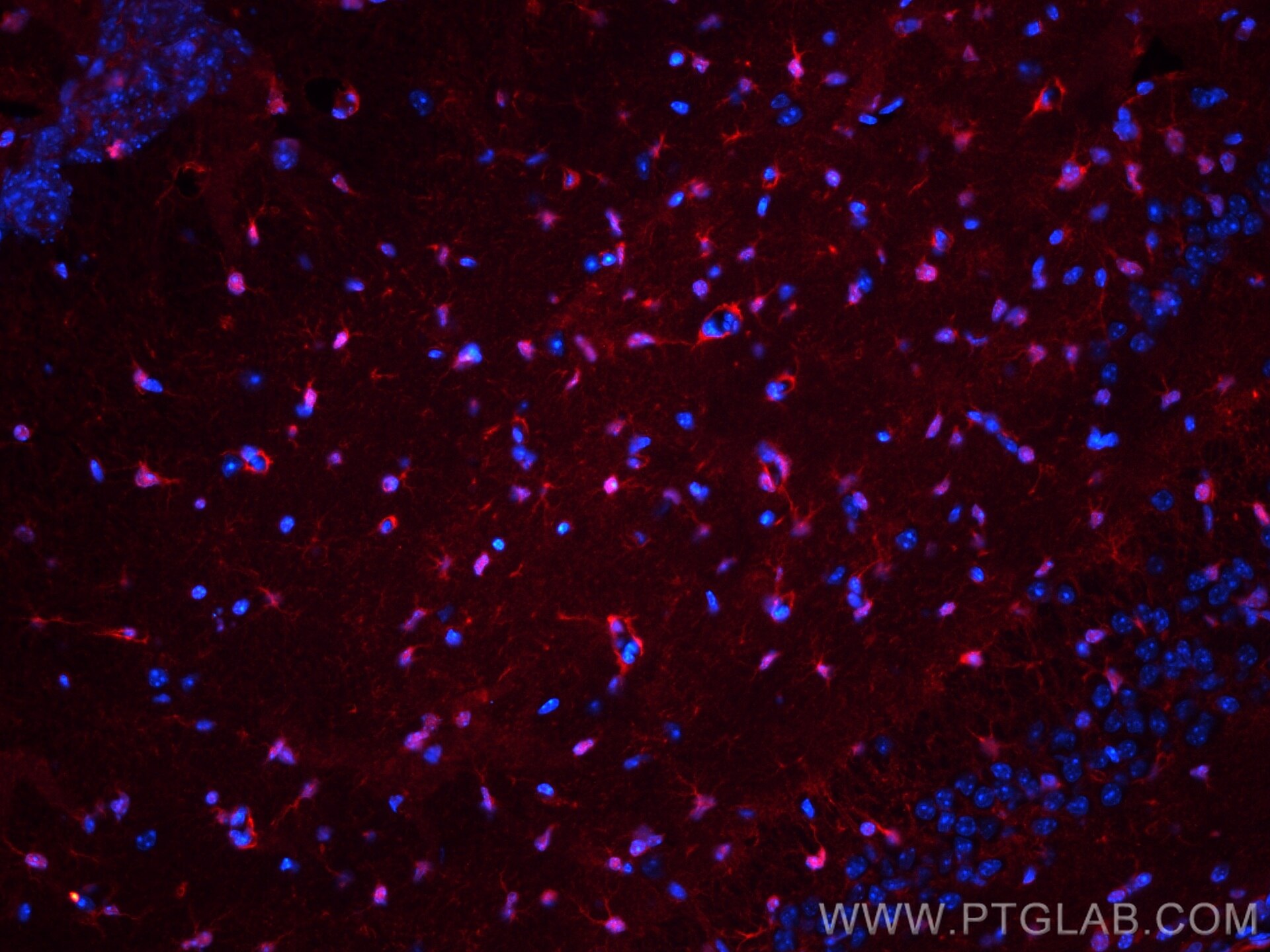 Immunofluorescence (IF) / fluorescent staining of mouse brain tissue using CoraLite®594-conjugated S100 Beta Polyclonal antib (CL594-15146)