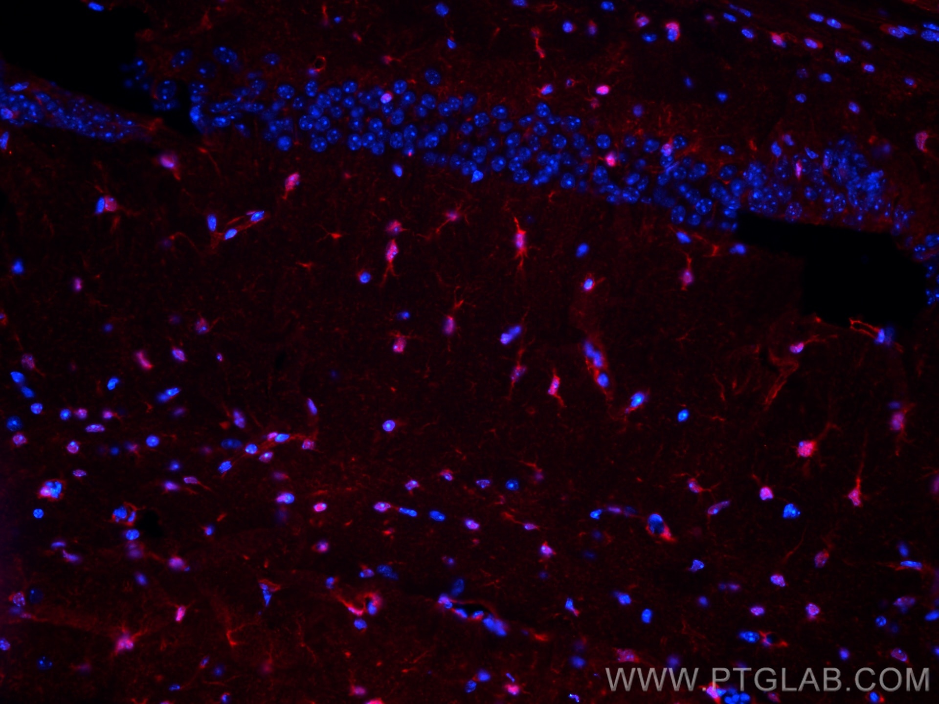 IF Staining of mouse brain using CL594-15146