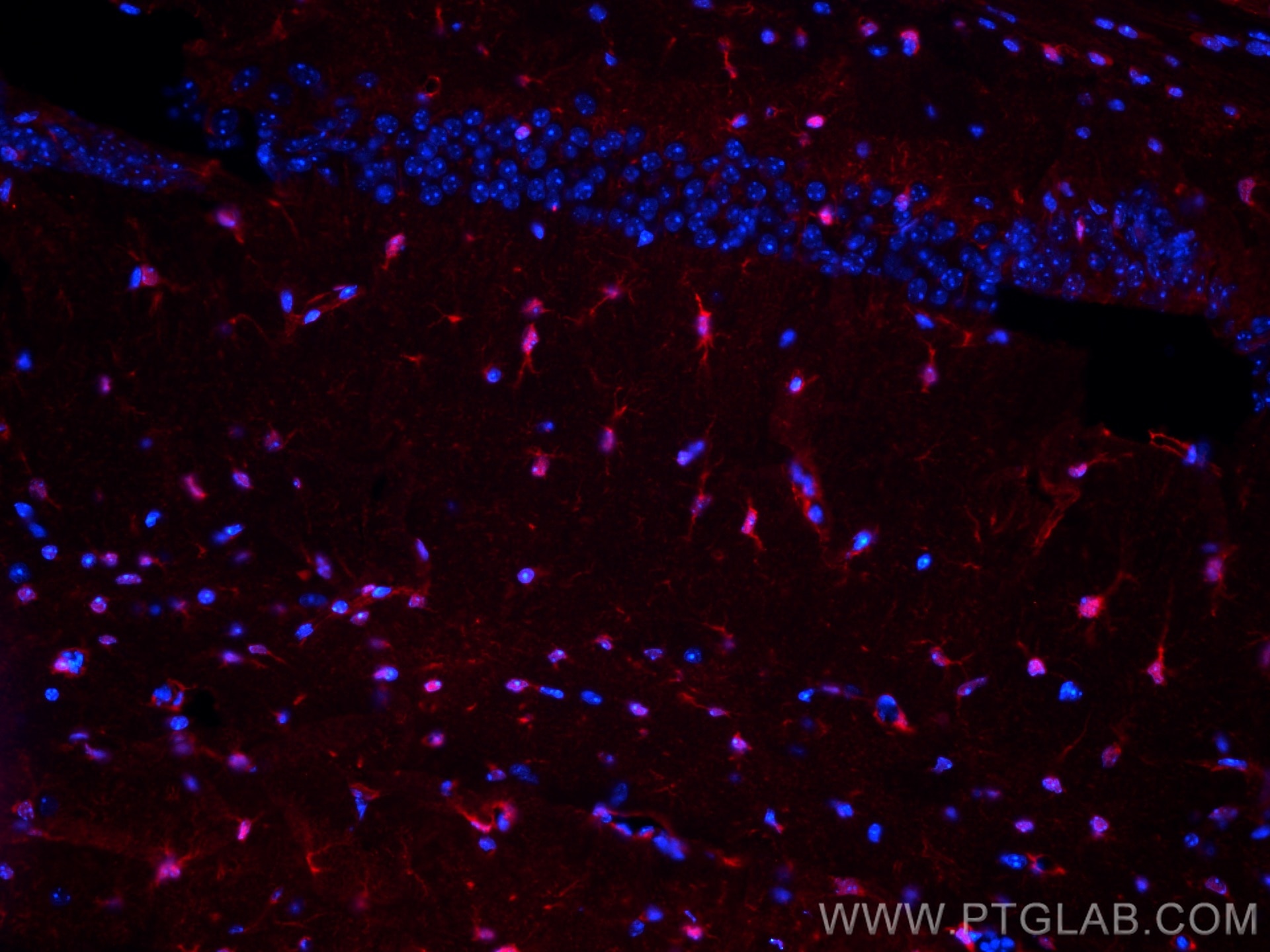 Immunofluorescence (IF) / fluorescent staining of mouse brain tissue using CoraLite®594-conjugated S100 Beta Polyclonal antib (CL594-15146)